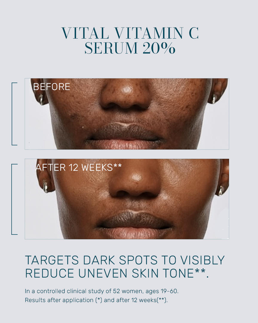 [ 2 - BRIGHTEN ] VITAL VIT-C RX
