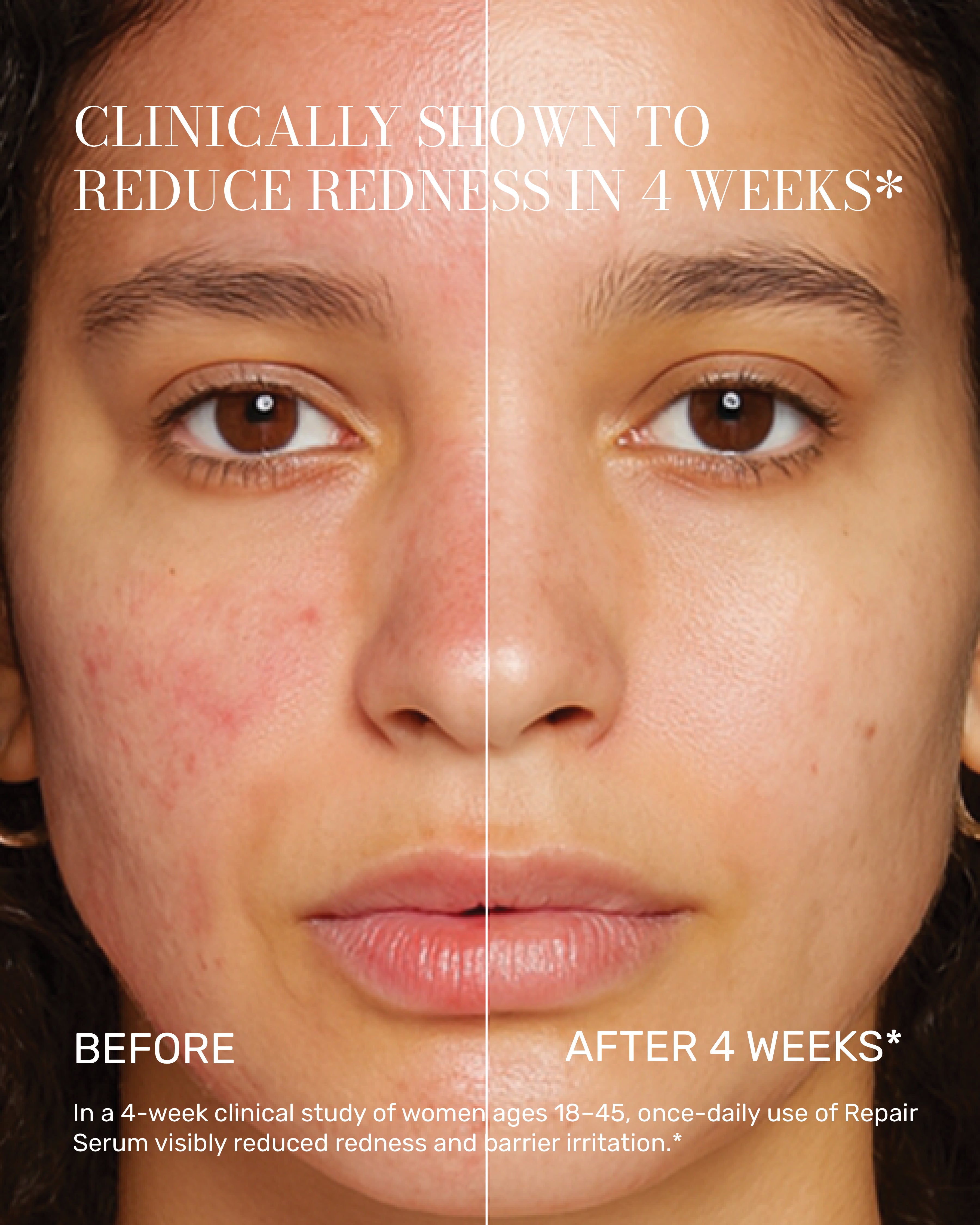 [ 4 - REPAIR ] REPAIR THERAPY SERUM